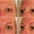 semi permanent makeup - eyebrows